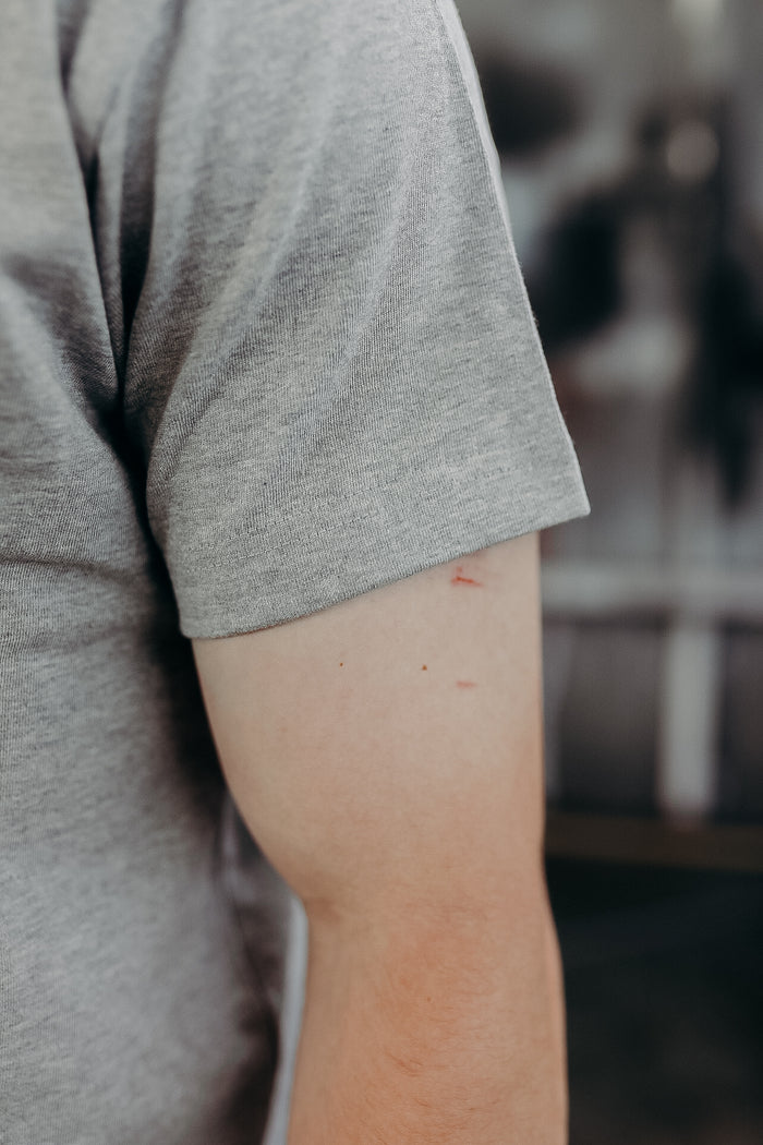 Close-up of a person's upper arm wearing a grey short sleeve shirt with small scratches on the skin